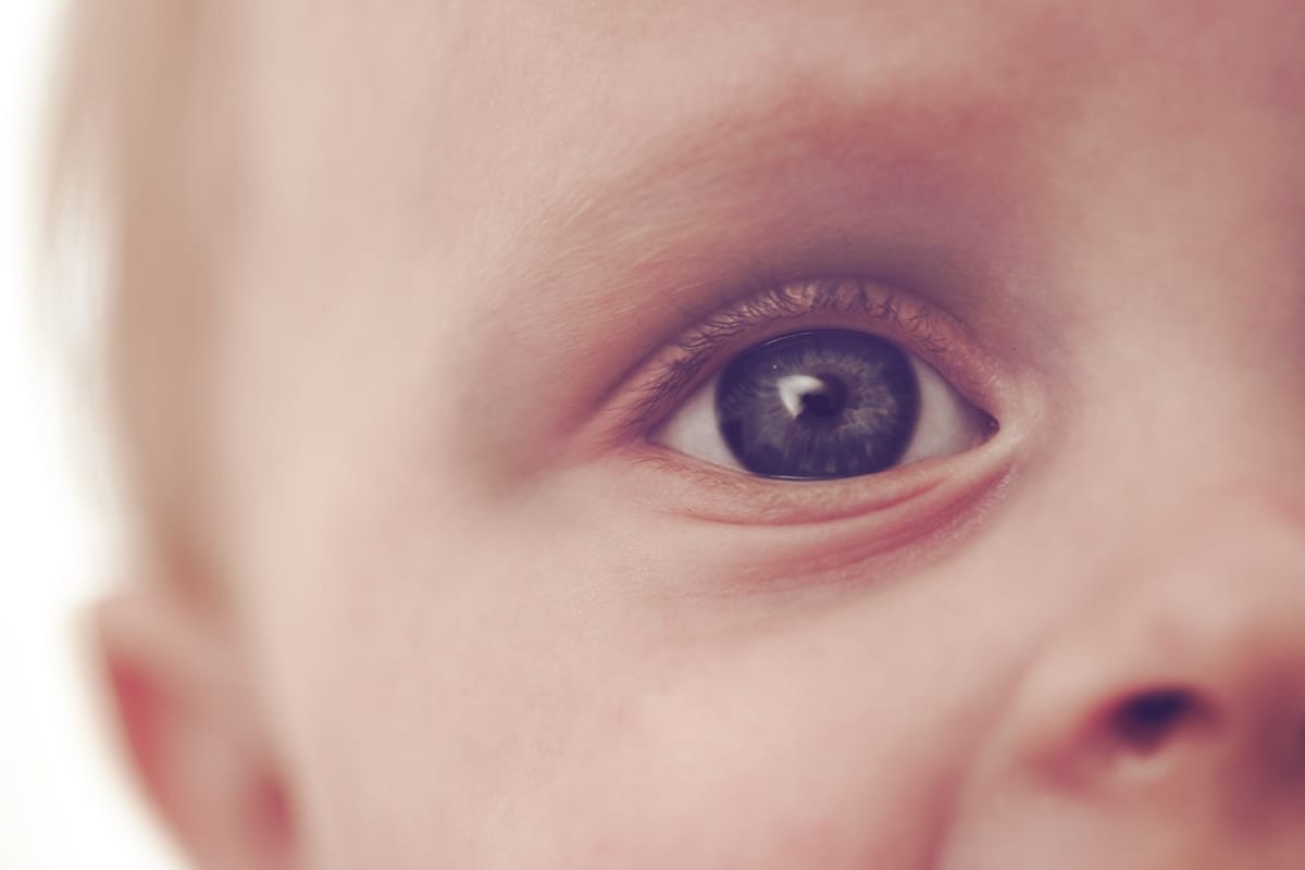 Rétinoblastome : deux signes qui doivent alerter les parents maliens